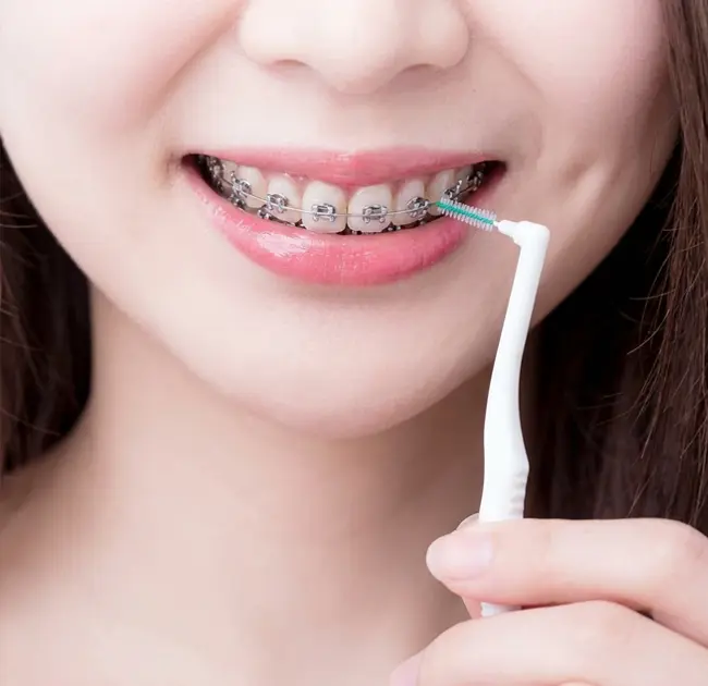 Interdentalbürsten schaffen ein neues Erlebnis raffinierter Mundpflege